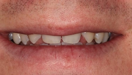 dental patient results in Philadelphia