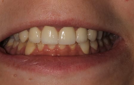 dental patient results in Philadelphia