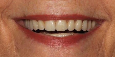dental patient results in Philadelphia