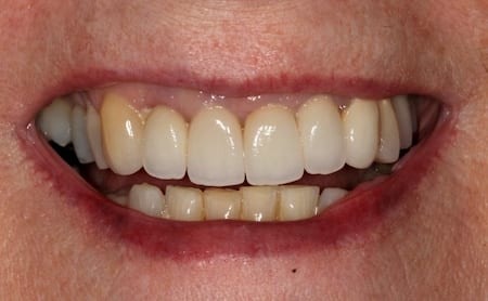 dental patient results in Philadelphia
